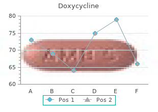 discount 100 mg doxycycline fast delivery