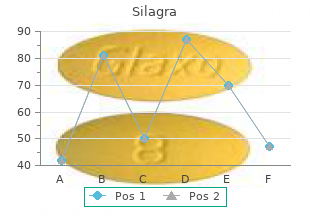 cheap silagra 50mg amex