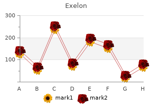 cheap exelon express