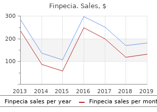 buy finpecia 1mg free shipping