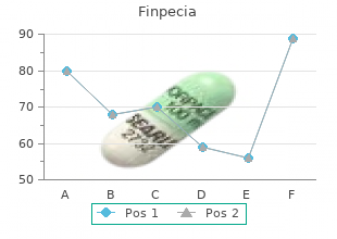 buy 1mg finpecia with mastercard