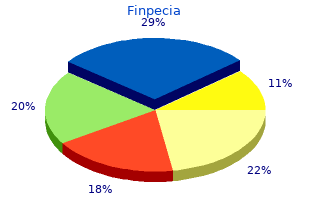discount finpecia 1 mg otc