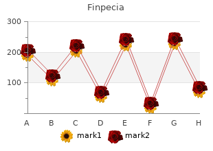 order finpecia with a mastercard