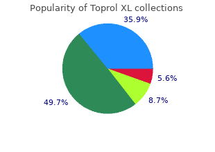 buy toprol xl on line amex