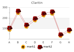 proven 10mg claritin
