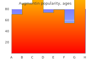 augmentin 625mg with mastercard
