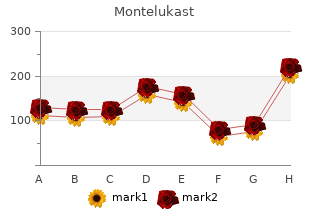 discount montelukast 4mg