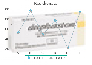 order residronate 35mg overnight delivery