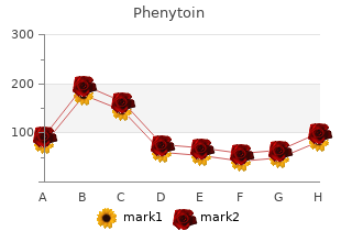 buy phenytoin 100mg on line