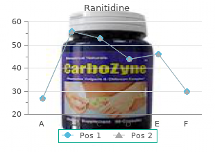 buy ranitidine on line amex