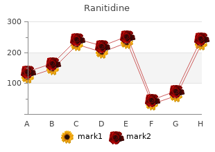 discount ranitidine online