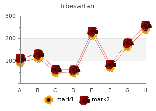 irbesartan 300mg without a prescription